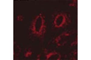 Immunocytochemistry/Immunofluorescence analysis using Mouse Anti-LAMP1 Monoclonal Antibody, Clone Ly1C6 . (LAMP1 抗体  (Atto 594))