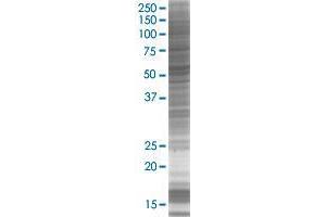 UGT3A1 transfected lysate. (UGT3A1 293T Cell Transient Overexpression Lysate(Denatured))