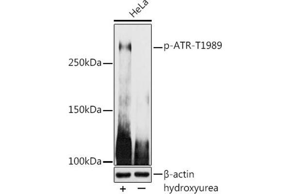 ATR 抗体  (pThr1989)