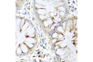 Immunohistochemistry of paraffin-embedded human colon using PI3 antibody (ABIN5974984) at dilution of 1/100 (40x lens). (PI3 抗体)