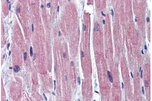 Human Heart: Formalin-Fixed, Paraffin-Embedded (FFPE) (TNNI3 抗体  (C-Term))