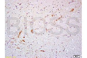 Formalin-fixed and paraffin embedded rat brain labeled with Anti- PROK2/Prokineticin 2 Polyclonal Antibody, Unconjugated (ABIN714701) at 1:200 followed by conjugation to the secondary antibody and DAB staining (PROK2 抗体  (AA 28-100))