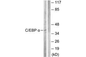 Western Blotting (WB) image for anti-CCAAT/enhancer Binding Protein (C/EBP), alpha (CEBPA) (AA 192-241) antibody (ABIN2888784) (CEBPA 抗体  (AA 192-241))
