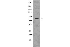 Western blot analysis of Phospho-IRAK4 (Thr345/Ser346) using 293 whole cell lysates (IRAK4 抗体  (pSer346, pThr345))