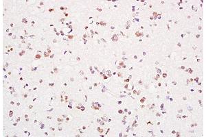 Immunohistochemistry (Paraffin-embedded Sections) (IHC (p)) image for anti-Proliferating Cell Nuclear Antigen (PCNA) (AA 151-261) antibody (ABIN676583)