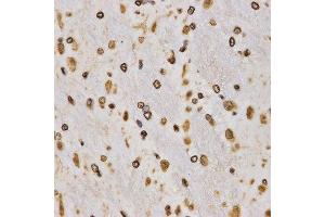 Immunohistochemistry (IHC) image for anti-Histone 3 (H3) (H3K27me) antibody (ABIN3023269)