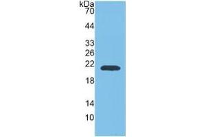 Western Blotting (WB) image for Matrix Metallopeptidase 9 (Gelatinase B, 92kDa Gelatinase, 92kDa Type IV Collagenase) (MMP9) ELISA Kit (ABIN6730943)