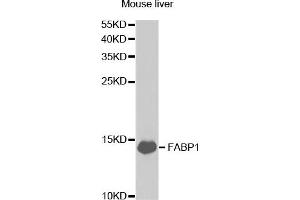 Western Blotting (WB) image for anti-Fatty Acid Binding Protein 1, Liver (FABP1) antibody (ABIN1876499) (FABP1 抗体)