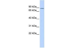 Western Blotting (WB) image for anti-Zinc Finger Protein 667 (ZNF667) antibody (ABIN2458200) (ZNF667 抗体)