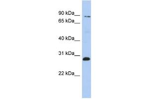 WB Suggested Anti-ZNF148 Antibody Titration:  0. (ZNF148 抗体  (Middle Region))