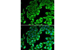 Immunofluorescence analysis of MCF7 cell using RPL14 antibody. (RPL14 抗体)