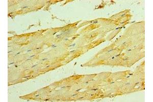 Immunohistochemistry of paraffin-embedded human skeletal muscle tissue using ABIN7154911 at dilution of 1:100 (HSPB2 抗体  (AA 1-182))