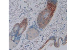 IHC-P analysis of skin tissue, with DAB staining. (SCEL 抗体  (AA 410-652))