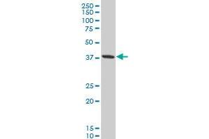 GOT2 polyclonal antibody (A01), Lot # FHC0061120QCS1 Western Blot analysis of GOT2 expression in A-431 . (GOT2 抗体  (AA 331-430))