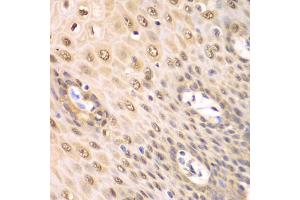 Immunohistochemistry of paraffin-embedded human esophagus using PSMA2 antibody. (PSMA2 抗体)