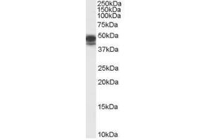 Image no. 1 for anti-Paired Box 8 (PAX8) (Internal Region) antibody (ABIN374803) (PAX8 抗体  (Internal Region))