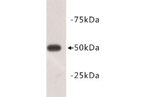 Western Blotting (WB) image for anti-Tubulin, beta 3 (TUBB3) (N-Term) antibody (ABIN1854950) (TUBB3 抗体  (N-Term))