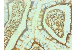 Immunohistochemical of paraffin-embedded human small intestine using ABIN7151798 at dilution of 1:200 (ENO2/NSE 抗体)