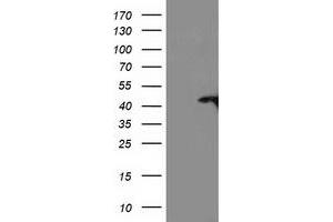 HEK293T cells were transfected with the pCMV6-ENTRY control (Left lane) or pCMV6-ENTRY TBC1D21 (Right lane) cDNA for 48 hrs and lysed. (TBC1D21 抗体)