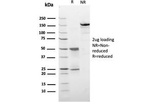 SDS-PAGE Analysis Purified HER-2 Monospecific Mouse Monoclonal Antibody (ERBB2/3257). (ErbB2/Her2 抗体  (AA 311-462))