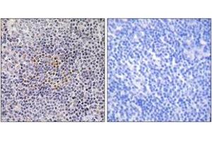 Immunohistochemistry (IHC) image for anti-X-Ray Repair Complementing Defective Repair in Chinese Hamster Cells 3 (XRCC3) (AA 41-90) antibody (ABIN2890031) (XRCC3 抗体  (AA 41-90))