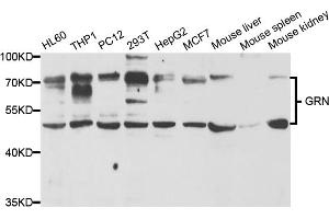 Western blot analysis of extracts of various cell lines, using GRN antibody (ABIN5973395) at 1/1000 dilution. (Granulin 抗体)