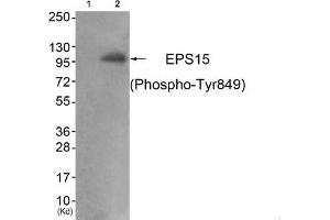 EPS15 抗体  (pTyr849)