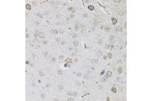 Immunohistochemistry of paraffin-embedded mouse brain using CEACAM5 antibody (ABIN6291892) (40x lens). (CEACAM5 抗体)