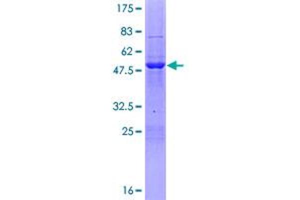 PHF19 Protein (AA 1-207) (GST tag)