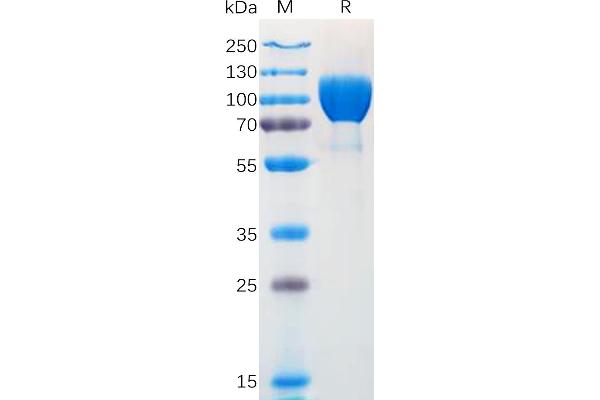 TRKA Protein (AA 33-410) (Fc Tag)