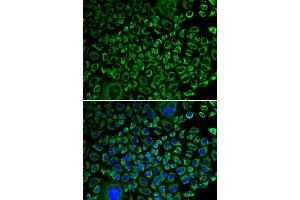 Immunofluorescence analysis of A549 cells using F10 antibody (ABIN5970678). (Coagulation Factor X 抗体)