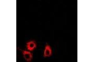 Immunofluorescence (IF) image for anti-SET and MYND Domain Containing 4 (SMYD4) (AA 1-260) antibody (ABIN5936313) (SMYD4 抗体  (AA 1-260))