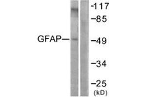 Western blot analysis of extracts from COLO205 cells, using GFAP (Ab-38) Antibody. (GFAP 抗体  (AA 11-60))