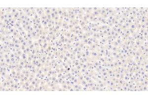 Detection of CPA1 in Rat Liver Tissue using Polyclonal Antibody to Carboxypeptidase A1, Pancreatic (CPA1) (CPA1 抗体  (AA 205-419))