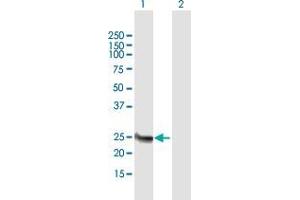 Methyltransferase Like 21B (METTL21B) (AA 1-226) 抗体