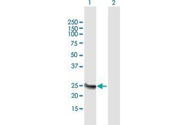 Methyltransferase Like 21B (METTL21B) (AA 1-226) 抗体