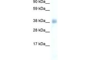 WB Suggested Anti-YY1 Antibody Titration:  0. (YY1 抗体  (Middle Region))