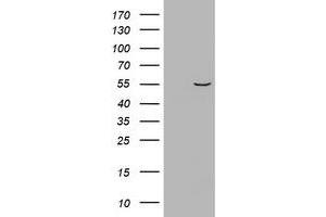 Image no. 1 for anti-Vimentin (VIM) (AA 210-466) antibody (ABIN1491201) (Vimentin 抗体  (AA 210-466))