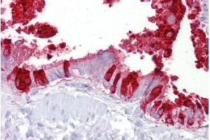 Immunohistochemistry with Lung, respiratory epithelium tissue at an antibody concentration of 5µg/ml using anti-SCGB1A1 antibody (ARP41524_P050) (SCGB1A1 抗体  (Middle Region))