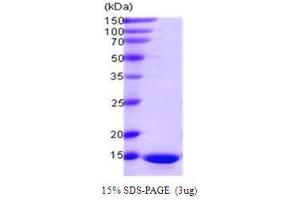 Figure annotation denotes ug of protein loaded and % gel used. (PDCD5 Protein (AA 1-125))