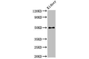 Western Blot Positive WB detected in: Mouse kidney tissue All lanes: PDK1 antibody at 2. (PDPK1 抗体  (AA 294-432))