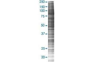 TTC7B transfected lysate. (TTC7B 293T Cell Transient Overexpression Lysate(Denatured))