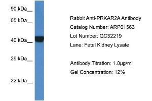 Western Blotting (WB) image for anti-Protein Kinase, CAMP-Dependent, Regulatory, Type II, alpha (PRKAR2A) (Middle Region) antibody (ABIN786444) (PRKAR2A 抗体  (Middle Region))