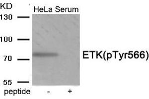 Western blot analysis of extracts from HeLa cells treated with Serum using Phospho-ETK (Tyr566) antibody. (BMX 抗体  (pTyr566))