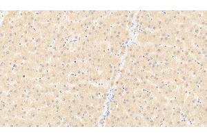Detection of CD40L in Human Liver Tissue using Polyclonal Antibody to Cluster Of Differentiation 40 Ligand (CD40L) (CD40 Ligand 抗体  (AA 1-261))