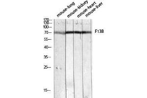 Western Blot (WB) analysis of Mouse Lung Mouse Kidney Mouse Heart Mouse Liver lysis using F13B antibody. (F13B 抗体)