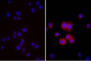 Human pancreatic carcinoma cell line MIA PaCa-2 was stained with Mouse Anti-Human CD44-UNLB, and DAPI. (驴 anti-小鼠 IgG (Heavy & Light Chain) Antibody (HRP) - Preadsorbed)