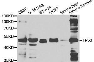 Western blot analysis of extracts of various cell lines, using TP53 antibody. (p53 抗体)