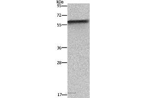 Western blot analysis of Mouse liver tissue, using FKBP8 Polyclonal Antibody at dilution of 1:1150 (FKBP8 抗体)