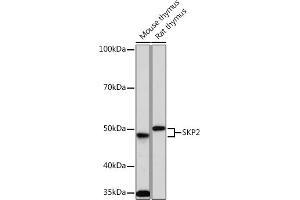 Western blot analysis of extracts of various cell lines, using SKP2 Rabbit mAb (ABIN1680764, ABIN3018459, ABIN3018460 and ABIN7101615) at 1:1000 dilution. (SKP2 抗体)